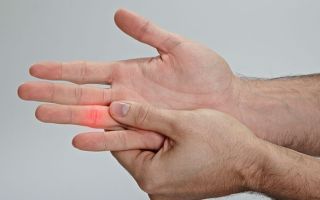 How to restore a finger after a fracture