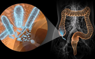 How to restore intestinal flora after antibiotics