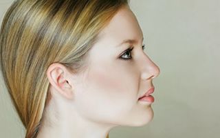 Recovery after rhinoplasty