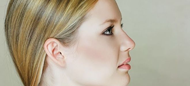 Recovery after rhinoplasty