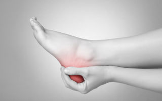 What is a callus after a fracture?