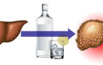 Как восстановить печень после длительного употребления алкоголя?
