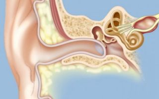 Hearing recovery after otitis media