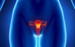 Rehabilitation after radiation therapy of the cervix