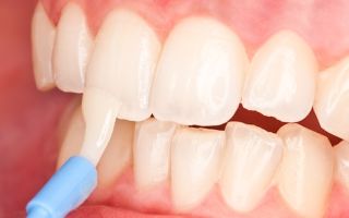 Restoration of tooth enamel