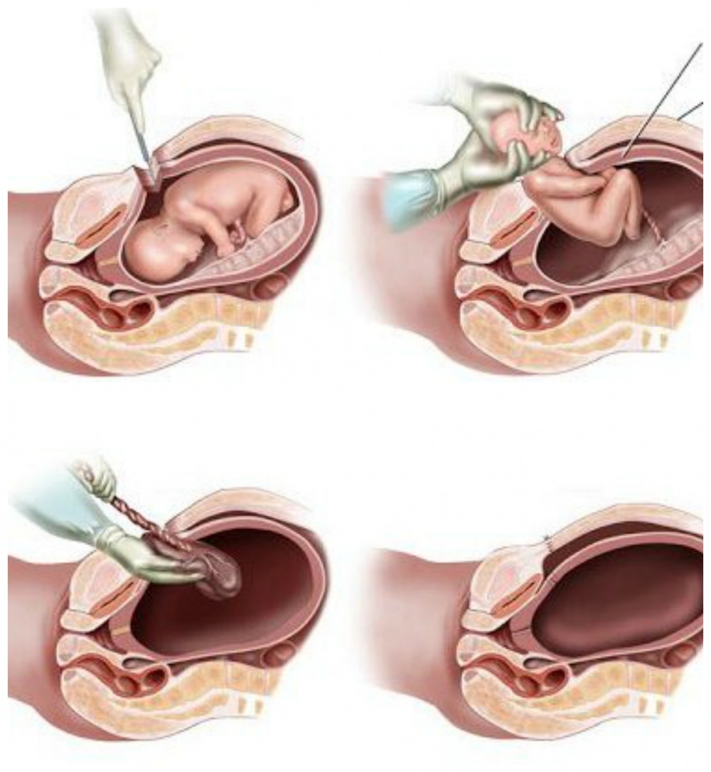 сокращения матки оргазм беременность фото 32